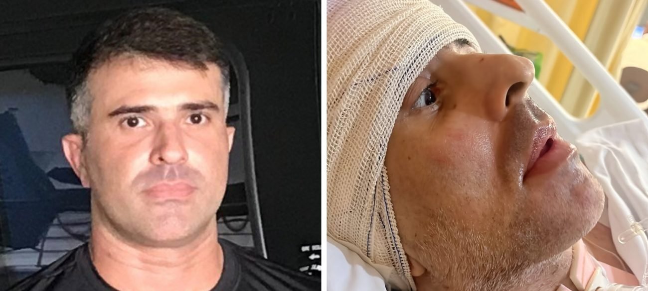 Piloto da Core alvejado na cabeça por fuzil em 2025 morre no Rio após nove meses de internação - Imagem do artigo original