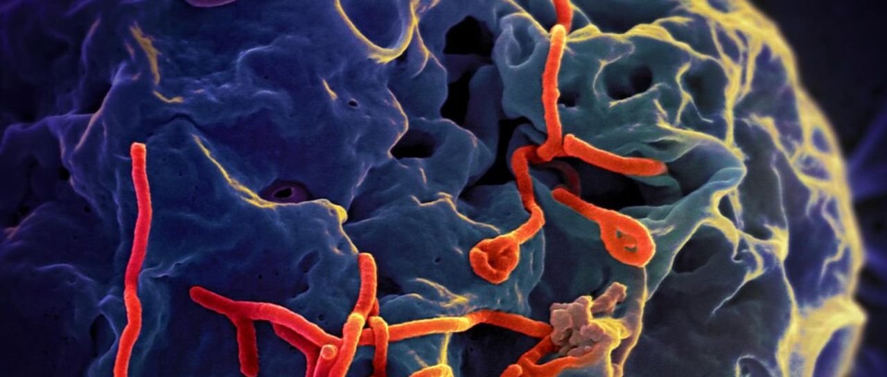 Surto de ebola causado pela cepa Bundibugyo desafia resposta global e expõe vulnerabilidades no nordeste do Congo - Imagem do artigo